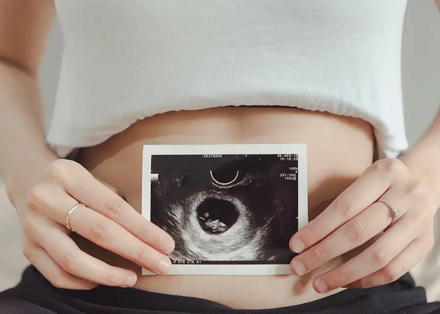 Catching Glimpses 4D Ultrasound - 2D ultrasound image, baby 8 weeks - Effingham, IL